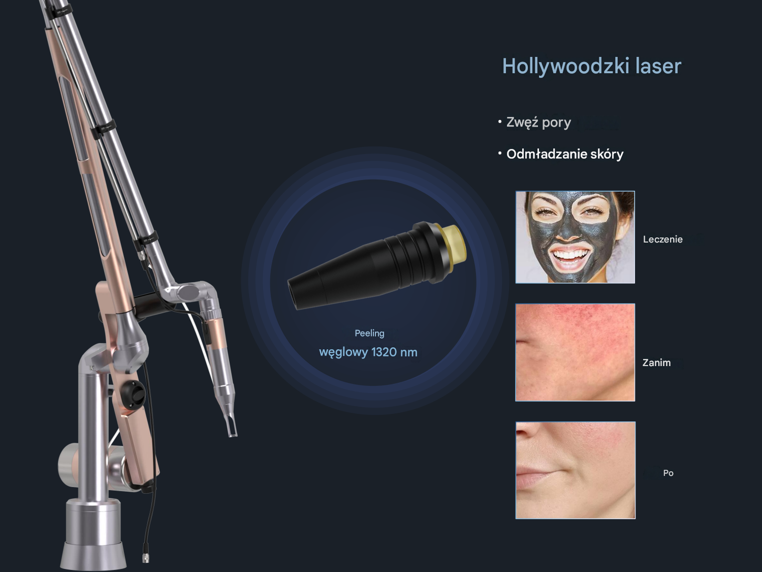 Hollywoodzki laser — peeling węglowy 1320 nm